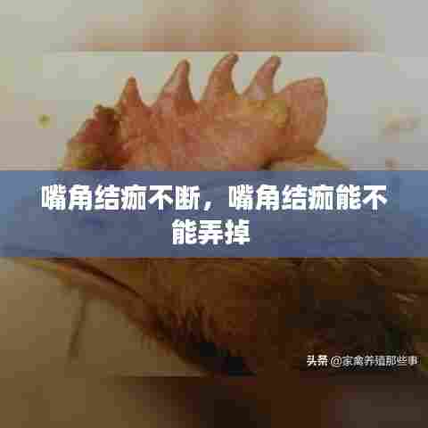 嘴角结痂不断，嘴角结痂能不能弄掉 