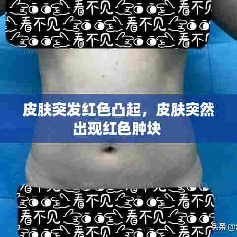 皮肤突发红色凸起，皮肤突然出现红色肿块 