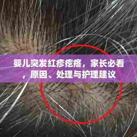 婴儿突发红疹疙瘩，家长必看，原因、处理与护理建议