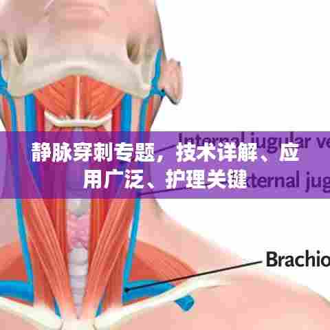 静脉穿刺专题，技术详解、应用广泛、护理关键