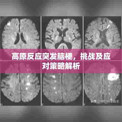 高原反应突发脑梗，挑战及应对策略解析