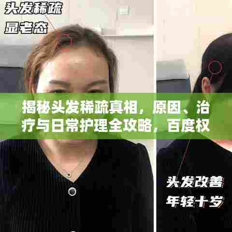 揭秘头发稀疏真相，原因、治疗与日常护理全攻略，百度权威收录！