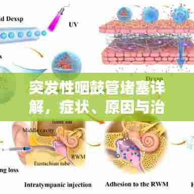 突发性咽鼓管堵塞详解，症状、原因与治疗方法全解析